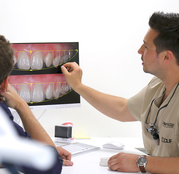 Clif Dentistes, ESTHÉTIQUE ET DENTISTERIE ADHÉSIVE